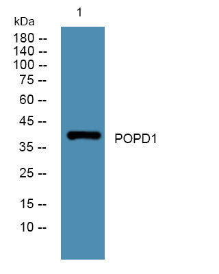 Anti-BVES antibody (STJ190612) – Figure 1 of 1