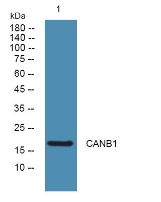 Anti-PPP3R1 antibody (STJ190618) – Figure 1 of 1
