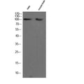 Anti-CHERP antibody (STJ190622) – Figure 1 of 1