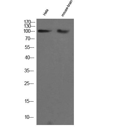 Anti-CHERP antibody (STJ190622) – Figure 1 of 1