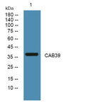Anti-CAB39 antibody (STJ190629) – Figure 1 of 1