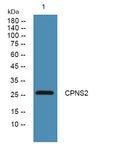 Anti-CAPNS2 antibody (STJ190640) – Figure 1 of 1