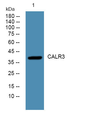 Anti-CALR3 antibody (STJ190646) – Figure 1 of 1