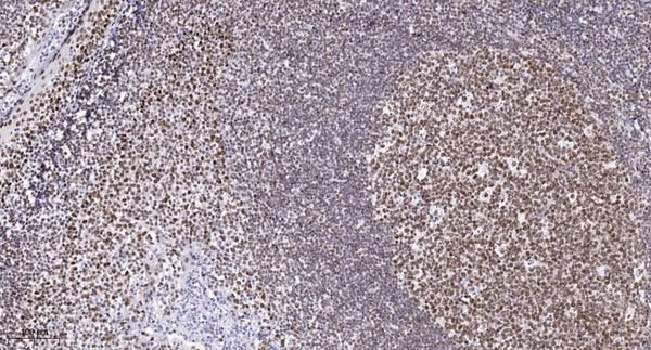 Anti-CHD6 antibody (STJ190697) – Figure 1 of 1