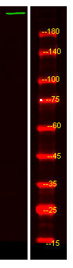 Anti-ZFC3H1 antibody (STJ190714) – Figure 1 of 1