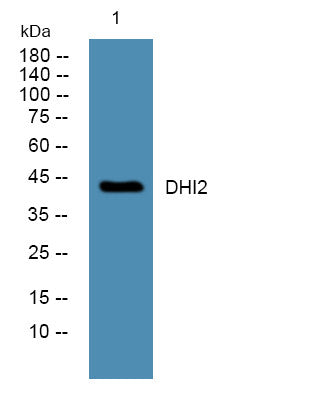 Anti-HSD11B2 antibody (STJ190726) – Figure 1 of 1
