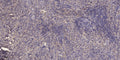 Anti-DYNC1H1 antibody (STJ190774) – Figure 1 of 1