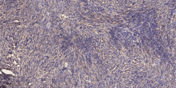 Anti-DYNC1H1 antibody (STJ190774) – Figure 1 of 1
