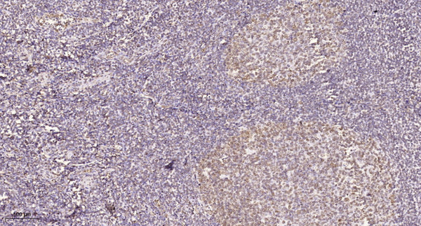 Anti-HECTD1 antibody (STJ190782) – Figure 1 of 1