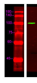 Anti-EDEM3 antibody (STJ190807) – Figure 1 of 1