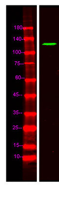 Anti-FNBP4 antibody (STJ190822) – Figure 1 of 1