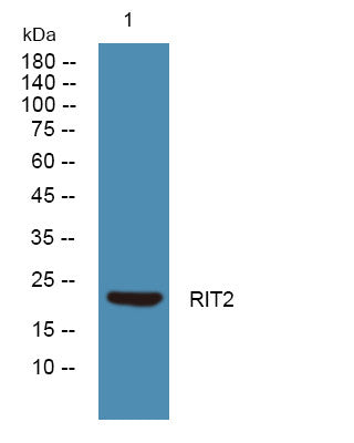 Anti-RIT2 antibody (STJ190852) – Figure 1 of 1
