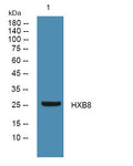 Anti-HOXB8 antibody (STJ190883) – Figure 1 of 1