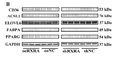 Anti-ACSL1 antibody (210-290 aa) (STJ190931) – Figure 1 of 1