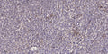 Anti-LRP2 antibody (2890-2970 aa) (STJ190936) – Figure 1 of 1