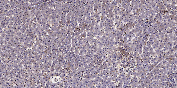 Anti-LRP2 antibody (2890-2970 aa) (STJ190936) – Figure 1 of 1