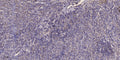Anti-MAP1A antibody (1860-1940 aa) (STJ190959) – Figure 1 of 1