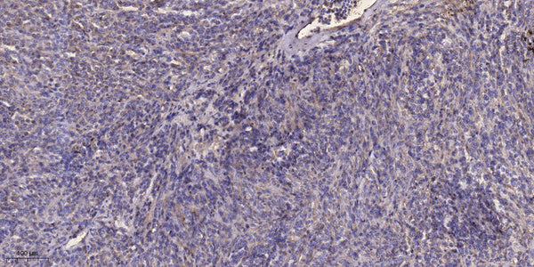 Anti-MAP1A antibody (1860-1940 aa) (STJ190959) – Figure 1 of 1