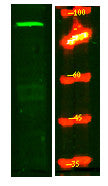 Anti-MPHOSPH8 antibody (290-370 aa) (STJ190980) – Figure 1 of 1