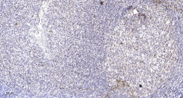 Anti-KMT2D antibody (1430-1510 aa) (STJ190998) – Figure 1 of 1