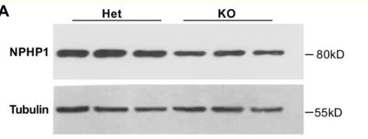 Anti-NPHP1 antibody (510-590 aa) (STJ191046) – Figure 1 of 1