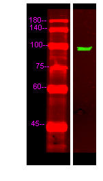 Anti-UNC5C antibody (60-140 aa) (STJ191050) – Figure 1 of 1