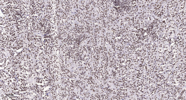 Anti-NAV3 antibody (430-510 aa) (STJ191073) – Figure 1 of 1