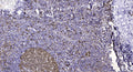 Anti-NIPBL antibody (560-640 aa) (STJ191086) – Figure 1 of 1