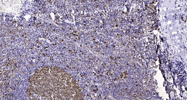 Anti-NIPBL antibody (560-640 aa) (STJ191086) – Figure 1 of 1