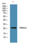 Anti-PRRX2 antibody (20-100 aa) (STJ191127) – Figure 1 of 1