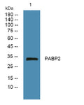 Anti-PABPN1 antibody (170-250 aa) (STJ191174) – Figure 1 of 1