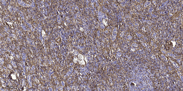 Anti-BOD1L1 antibody (1280-1360 aa) (STJ191212) – Figure 1 of 1