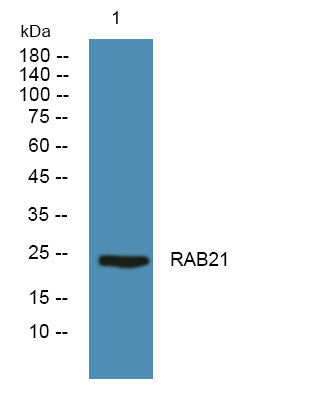 Anti-RAB21 antibody (60-140 aa) (STJ191274) – Figure 1 of 1