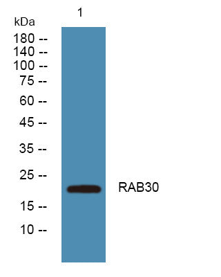 Anti-RAB30 antibody (80-160 aa) (STJ191279) – Figure 1 of 1