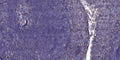 Anti-RELN antibody (270-350 aa) (STJ191304) – Figure 1 of 1