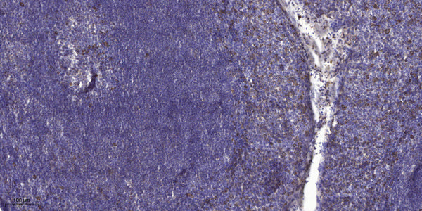 Anti-RELN antibody (270-350 aa) (STJ191304) – Figure 1 of 1