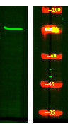 Anti-ARHGEF4 antibody (270-350 aa) (STJ191327) – Figure 1 of 1