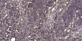 Anti-SPTBN4 antibody (STJ191461) – Figure 1 of 1