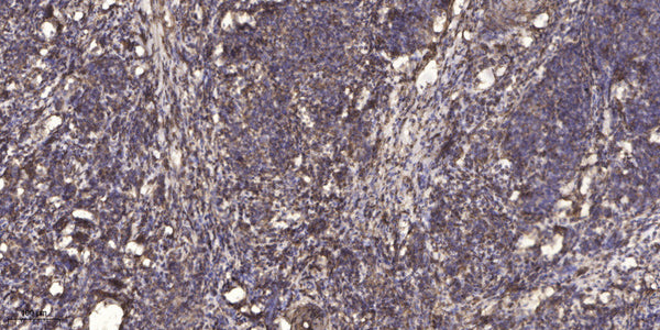 Anti-SPTBN4 antibody (STJ191461) – Figure 1 of 1