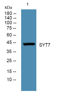 Anti-SYT7 antibody (STJ191495) – Figure 1 of 1