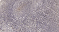 Anti-USP34 antibody (STJ191576) – Figure 1 of 1