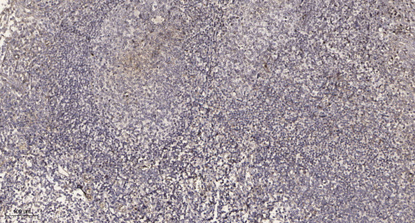 Anti-USP34 antibody (STJ191576) – Figure 1 of 1