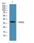 Anti-ATP6V0D2 antibody (STJ191614) – Figure 1 of 1