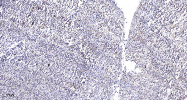 Anti-ZFHX2 antibody (STJ191642) – Figure 1 of 1