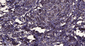 Anti-ZNF462 antibody (STJ191648) – Figure 1 of 1