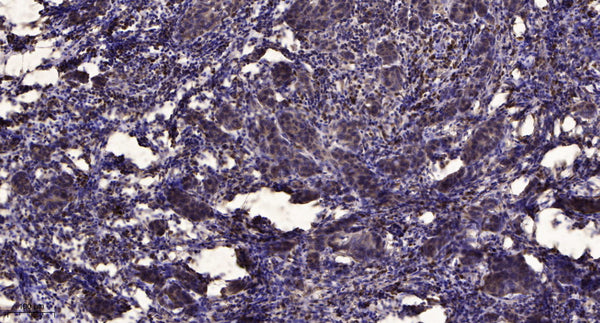 Anti-ZNF462 antibody (STJ191648) – Figure 1 of 1