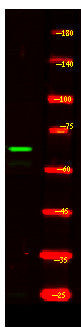 Anti-CCNK antibody (80-160 aa) (STJ191667) – Figure 1 of 1
