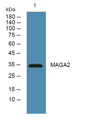 Anti-MAGEA2/MAGEA2B antibody (50-130 aa) (STJ191701) – Figure 1 of 1