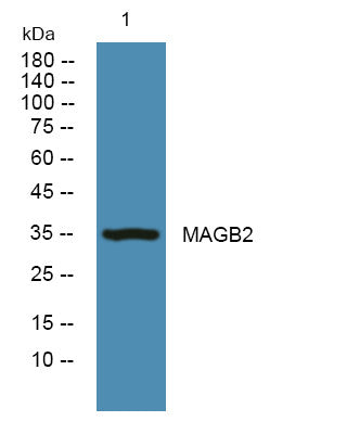 Anti-MAGEB2 antibody (30-110 aa) (STJ191707) – Figure 1 of 1