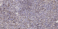 Anti-ASPM antibody (1230-1310 aa) (STJ191769) – Figure 1 of 1